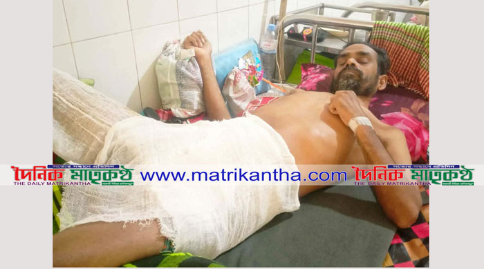 গোয়ালন্দে অপচিকিৎসায় ভুগছে দরিদ্র সুজন চিকিৎসা সহায়তার জন্য পরিবারের আবেদন